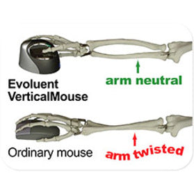 EVOL.4 VERTIC.MOUSE W-LESS,R-H