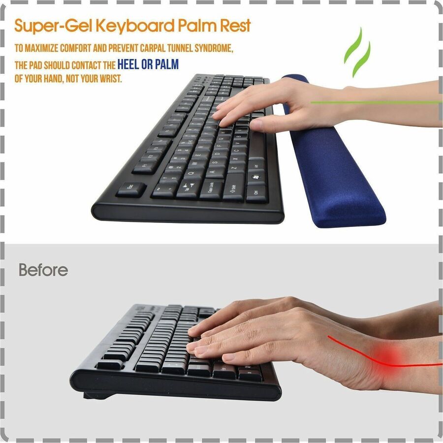 DAC&reg; MP-128 Super-Gel Straight Edge Keyboard Palm Support, Blue - 02124