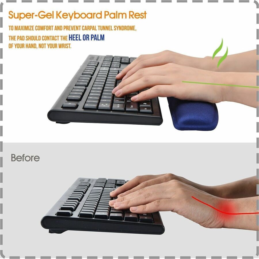 DAC&reg; MP-124 Super-Gel Contoured Keyboard Palm Support, Blue - 02122